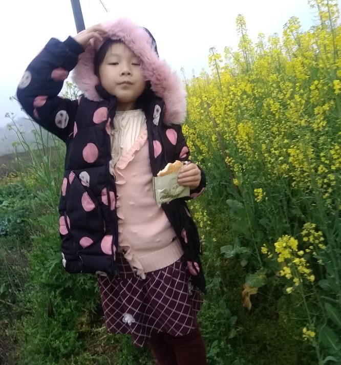 20180317可怜昕的虫牙